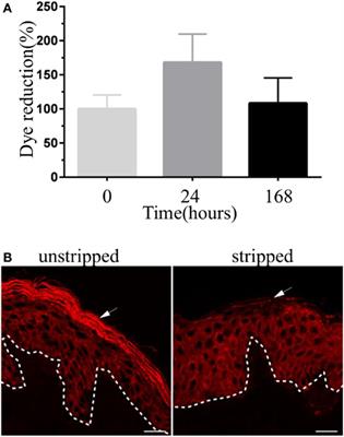 Deciphering the Pathological Role of Staphylococcal α-Toxin and Panton–Valentine Leukocidin Using a Novel Ex Vivo Human Skin Model